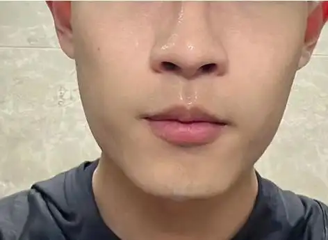 三,强效补水,细腻皮肤型