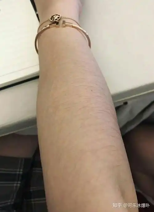 我是女生,体毛很多怎么办啊,可以用剃胡刀剃吗?