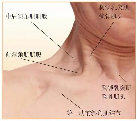 斜角肌体表标志