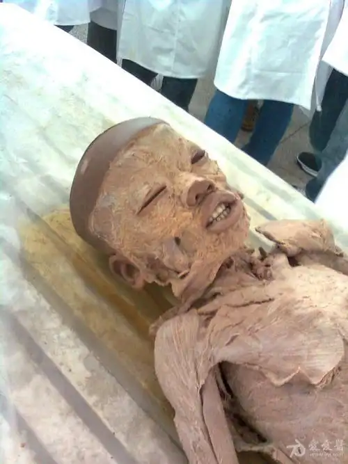 大体标本 - 临床病理讨论版 - 爱爱医医学论坛