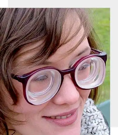 特属于高度近视