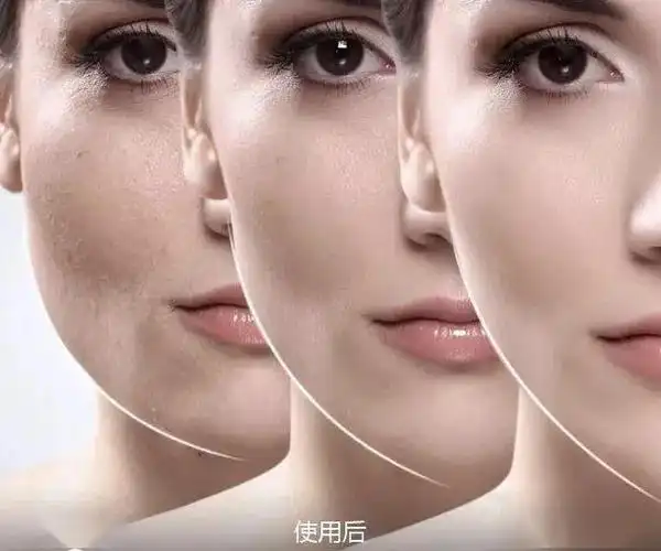 紧致上扬的面部曲线,年轻饱满的苹果肌以及立体的面部轮廓.