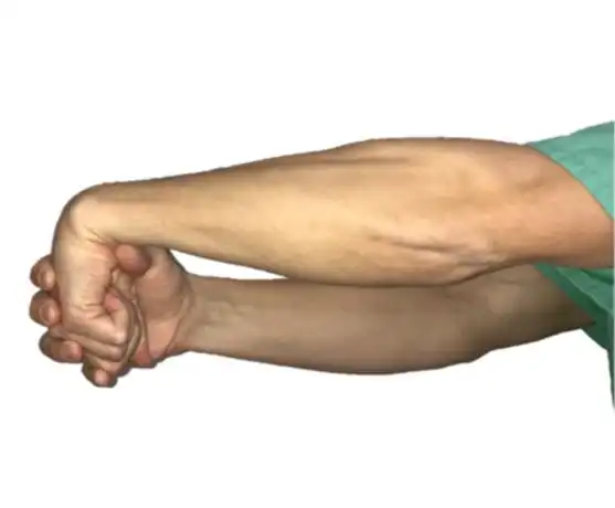 网球肘康复训练##微博健康公开课