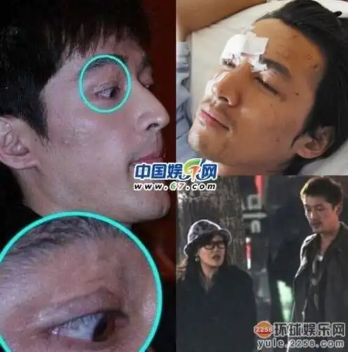 《仙剑奇侠传》主演十年今夕对比 胡歌车祸后重生