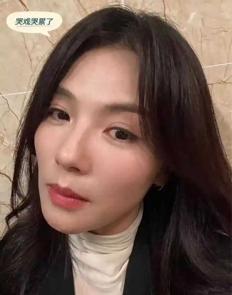 刘涛医美产生后遗症,淡妆出镜认不出,双目无神面容憔悴