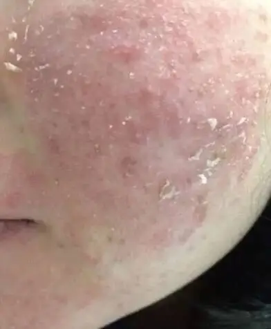 心急如焚, 想知道哪里出了问题又不想找医生来诊断?