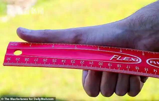 男生炫耀近13厘米超长大拇指 称打游戏特得劲儿