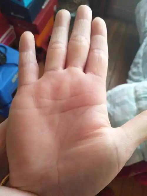 手相五条线解析运势只有一条贯穿整个手掌的直纹和金星丘边一条短的