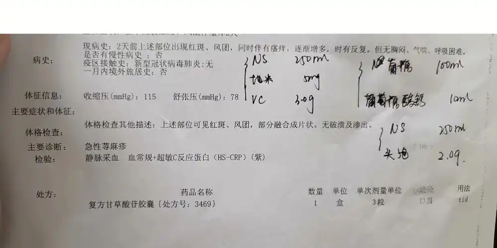 慢性荨麻疹  #荨麻疹  #皮肤科  #皮肤病防控方法:1.