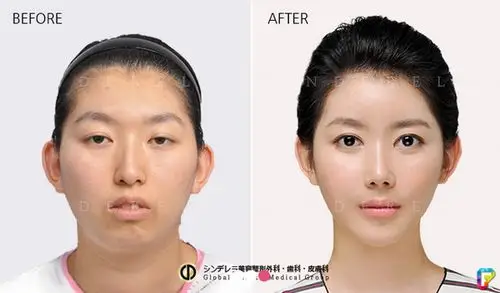 虽然我们看到过许多韩国人整容前后的震撼对比图,但是这15张图片又让