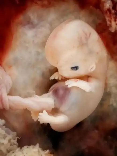 从怀孕到分娩宝宝在肚子里的胎儿照第一次看到这儿清晰的图