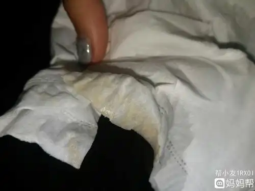 正常的白带是乳白色粘液状且无异味的白带的变化随着女性的机体功能