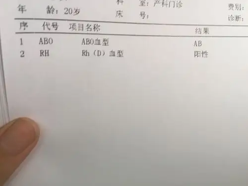 阿狸| 浏览 1 次来自:手机知道    10 分钟前  提问者采纳 ab血型啊