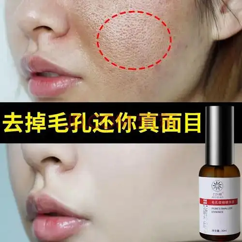 魔力收缩毛孔水精华液男女收敛细致修复毛孔粗大祛痘淡化痘印去黑头