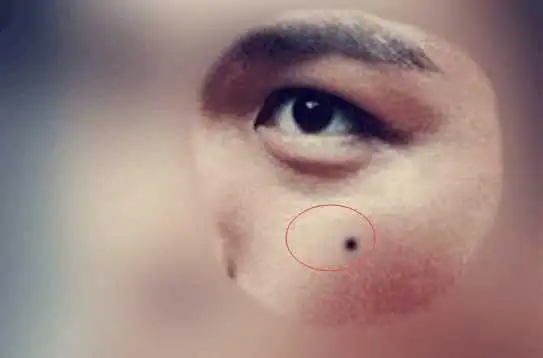 这六处长痣的男人最克妻,性格霸道怪癖多,既克妻财,又克妻命!