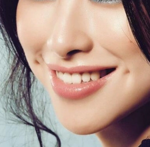 酒窝成形术让你拥有最美的笑容