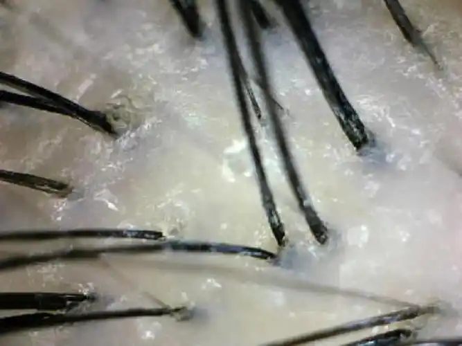 hairfax头皮养护日记day6