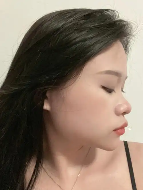 可惜了,90都交了结果体检没过#塌鼻子  #方脸  #整形问题