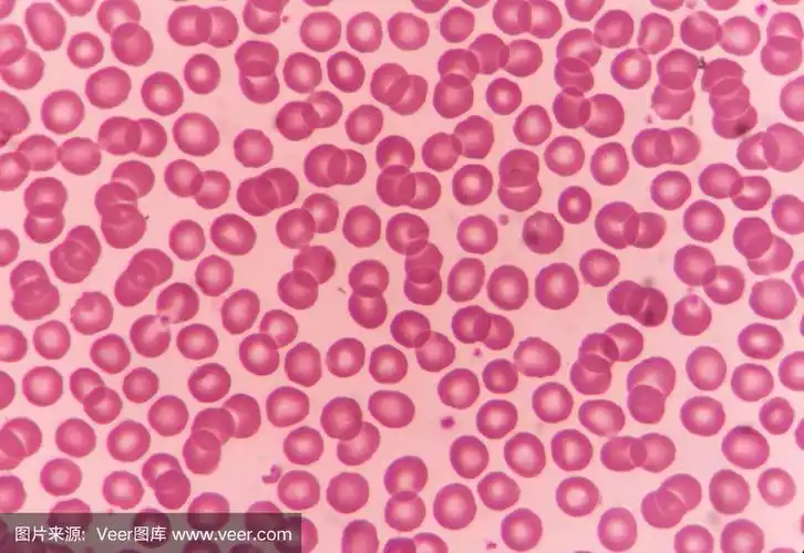 正常红细胞
