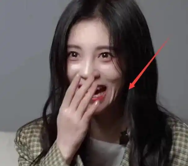 鞠婧祎表情失控,脸部褶皱不自然,网友:太吓人了