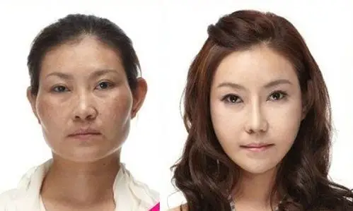 揭韩国美女明星整容对比照韩国每天造6000美女3