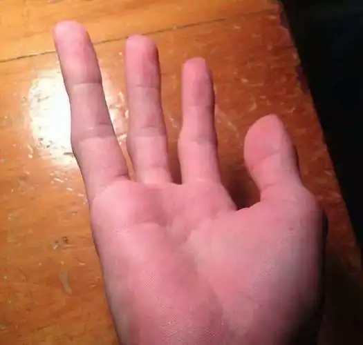 ▼她就是世界上肤色最深的模特儿:khoudia diop.▼他的瞳孔一边可以