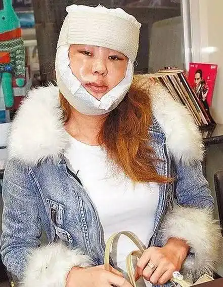 她就迫不及待想揪朋友来"参观"成果,还不避讳包着满脸纱布,戴着口罩