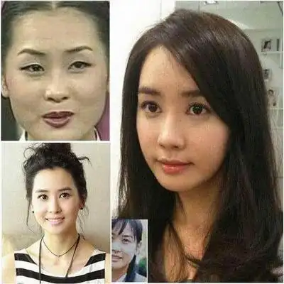 "变脸女王"韩星李多海整容成瘾大变样_网友整形经验谈_时尚美容_维美