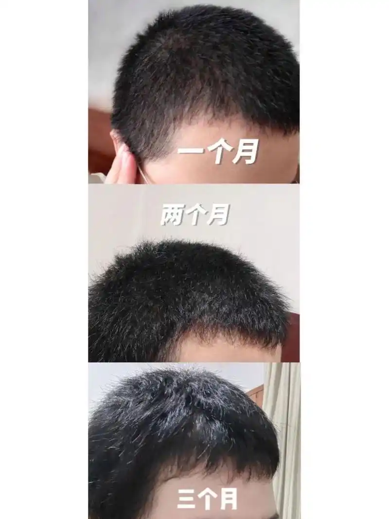 又能加速头发生长