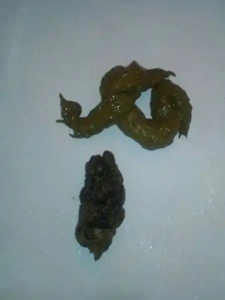 帮忙看下这是不是胃癌?