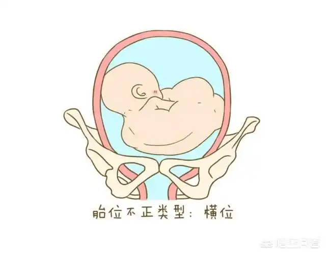 头条问答 - 孕34周胎动横位还能转正吗?(6个回答)