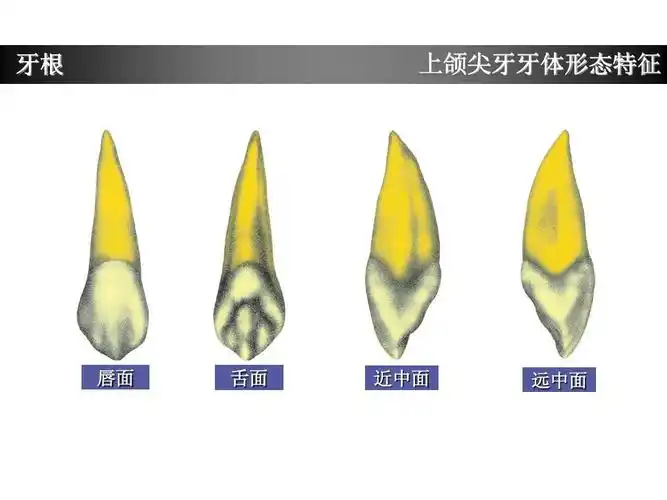 上颌尖牙牙体形态简述ppt