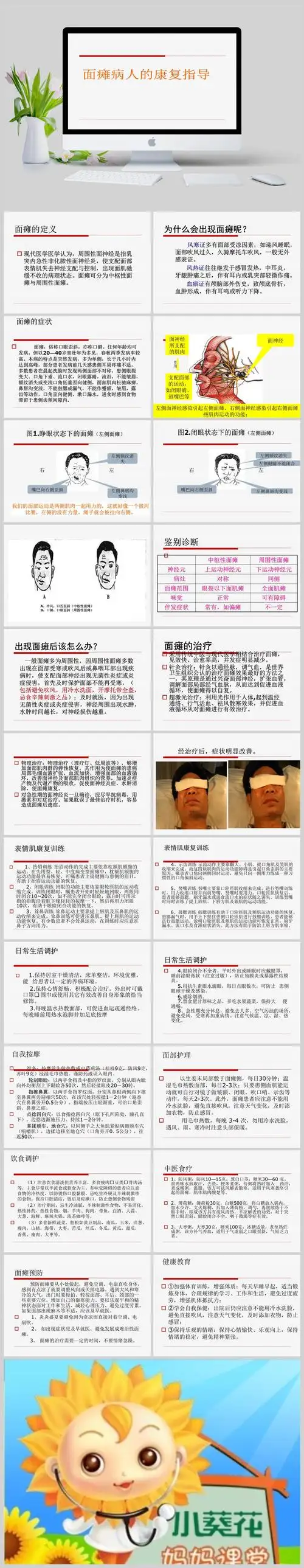 面瘫病人的康复指导ppt课件