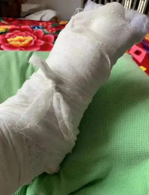 黄岛一市民去这家4s店修车被压断脚趾, 索赔难!