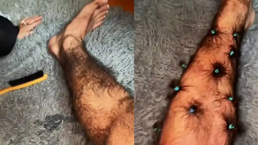 国外一小哥腿毛太长,都可以扎辫子了,网友:这都赶上我的发量了