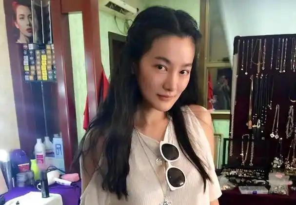 女明星方柏霓在社交媒体上晒出自己受伤的脚踝照片,揭露了丈夫于震