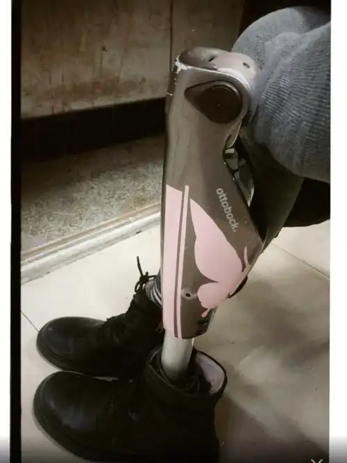ooto我给假肢换上了新皮肤