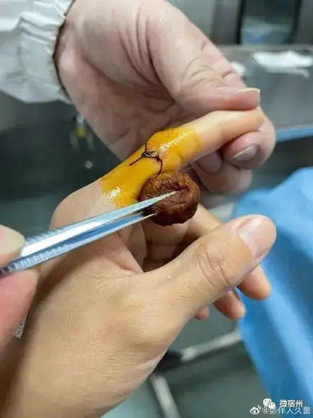 举着血淋淋的手指求助!