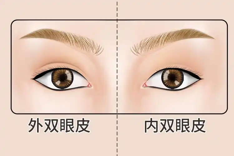 内双眼皮图片_39健康网_精编内容