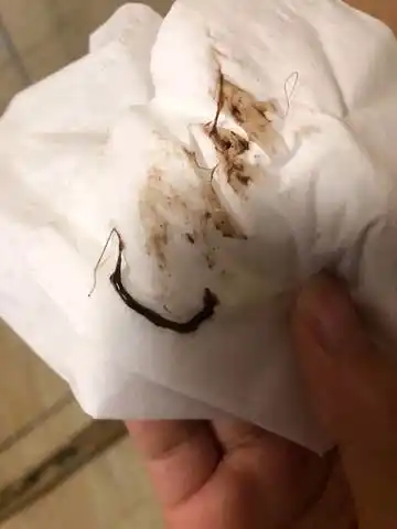 育儿问答 怀孕期 孕6周4天下面流血(褐色分泌物),要擦三次以上才能擦