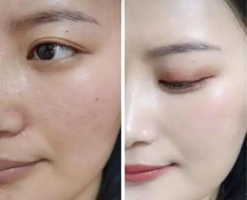 屈臣氏有种"断货王"面霜,7天美白去黄,效果堪比水光针