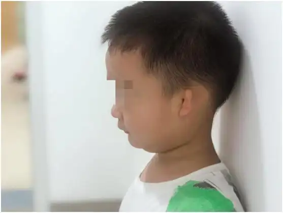 重庆市慈善总会援手又一7岁小耳畸形患儿获益