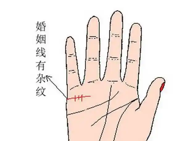 女人10处有痣是富贵痣婚姻线