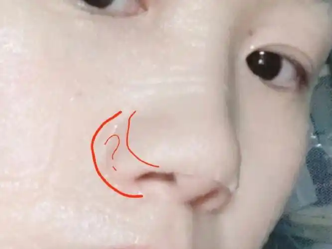 拜托05照顾一下鼻子大的人群