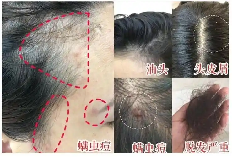 换季时间到对抗螨虫全靠它