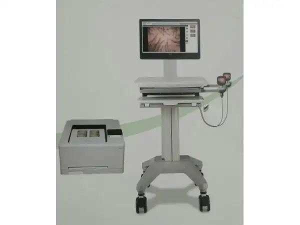 医用电子皮肤镜影像系统