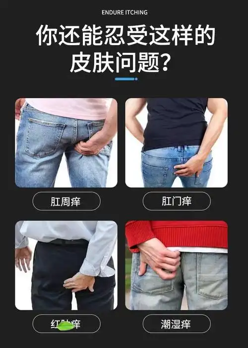 【买1送1】诚敬 玉庭舒抑菌膏(肛痒舒膏)10g 肛门潮湿肛周瘙痒屁眼痒