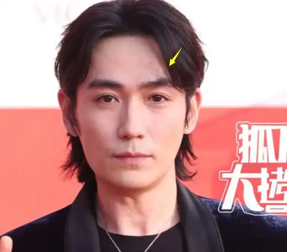 北京电影节朱一龙疤痕明显林志玲太尴尬有人脸肿有人整容