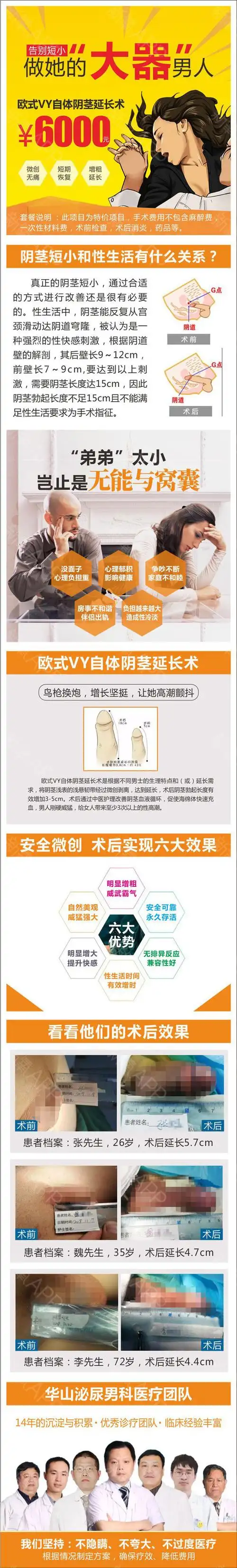 【阴茎增大】【阴茎延长】真皮阴茎增大/征服g点/一展雄风