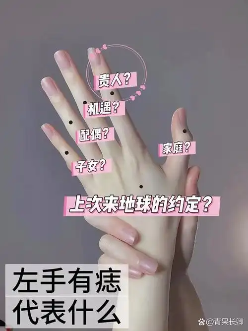 左手痣的含义,你了解多少?